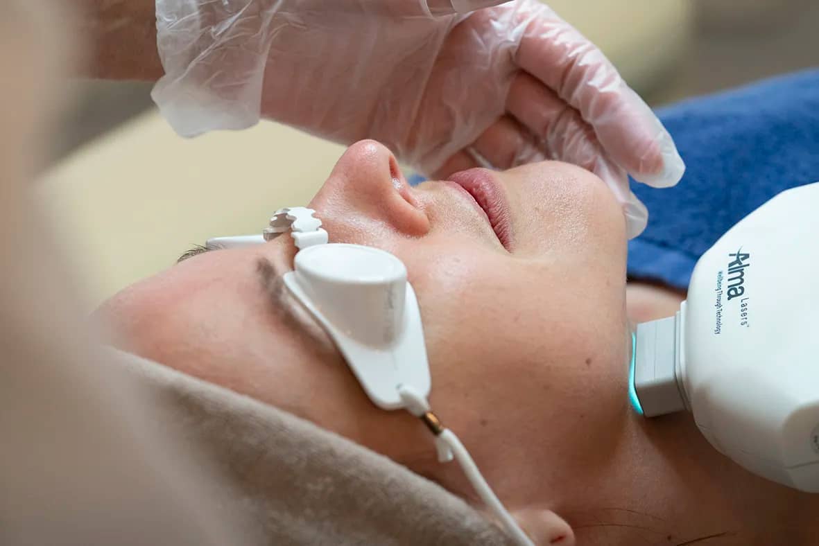 Lumière Intense Pulsée IPL à Paris