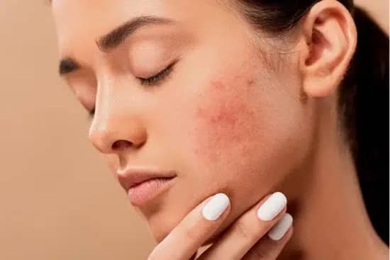 Soin visage peaux à imperfections à Paris