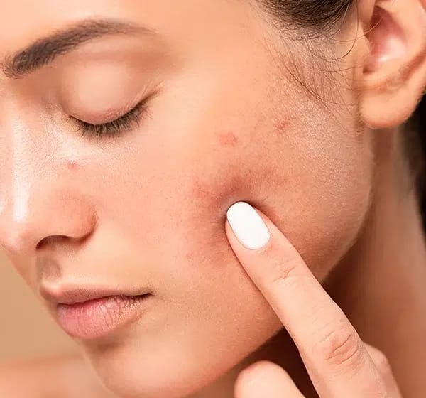 Soin visage peau grasse à Paris