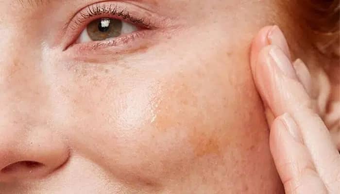 Soin visage peau sèche à Paris