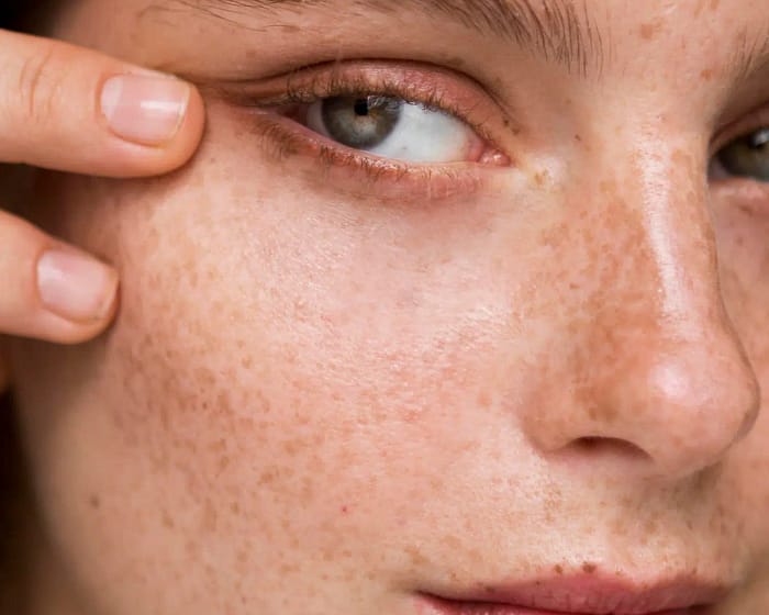 Soin contour des yeux à Paris