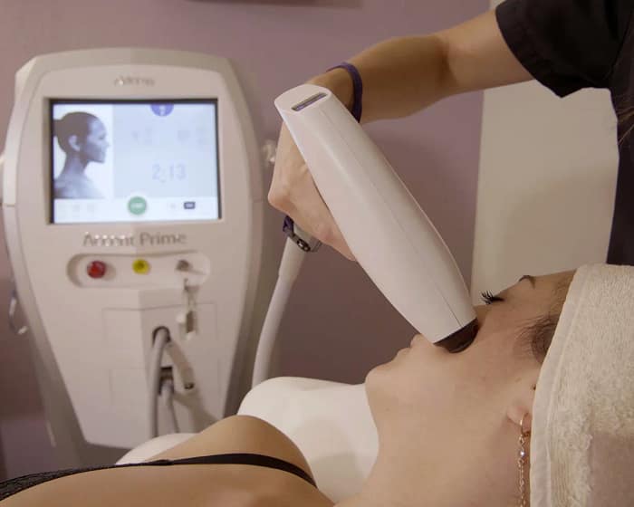 Radiofréquence et ultrasons pour le visage à Paris